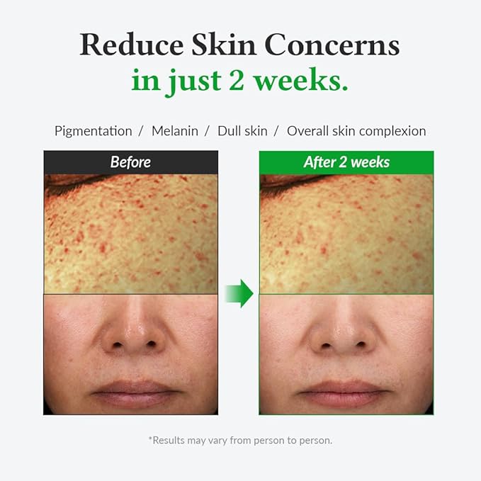 Dr.Althea 20% Gentle Vitamin C Serum 30 ml
