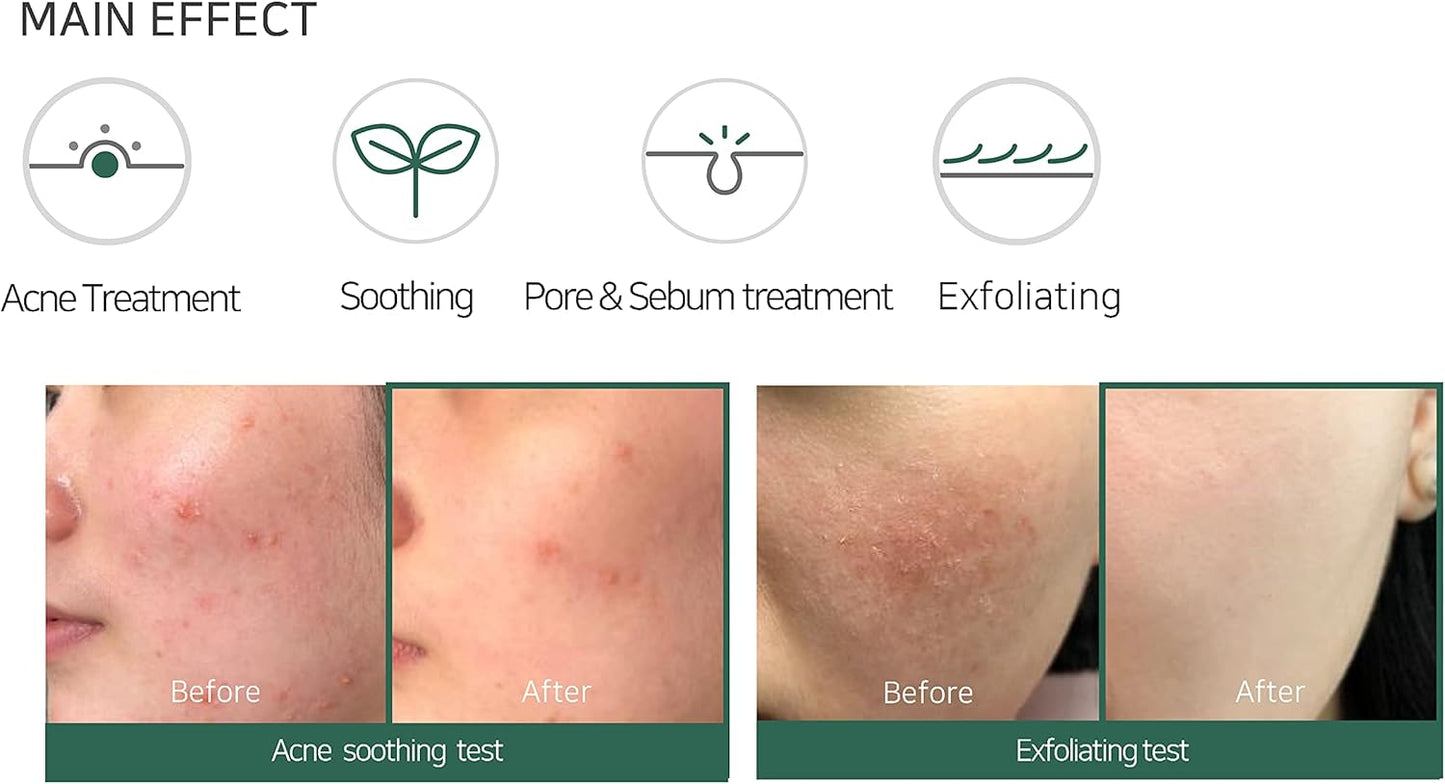SOME BY MI Miracle Acne Foam100 ml