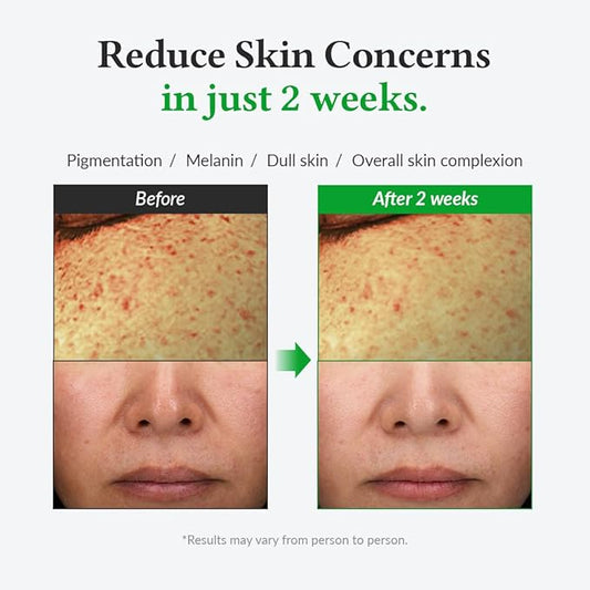 Dr.Althea 20% Gentle Vitamin C Serum 30 ml