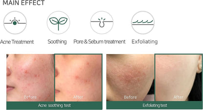 SOME BY MI Miracle Acne Foam100 ml